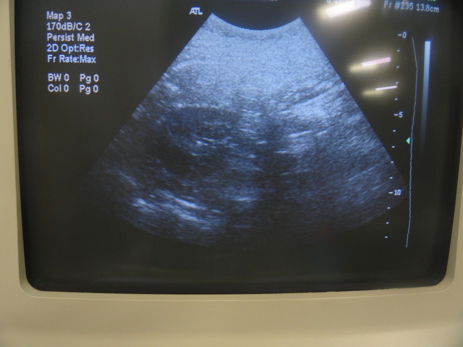 ATL HDI C4-2 40R Curved Array Broadband Probe (Abdominal General Imaging) 5940 DIAGNOSTIC ULTRASOUND MACHINES FOR SALE