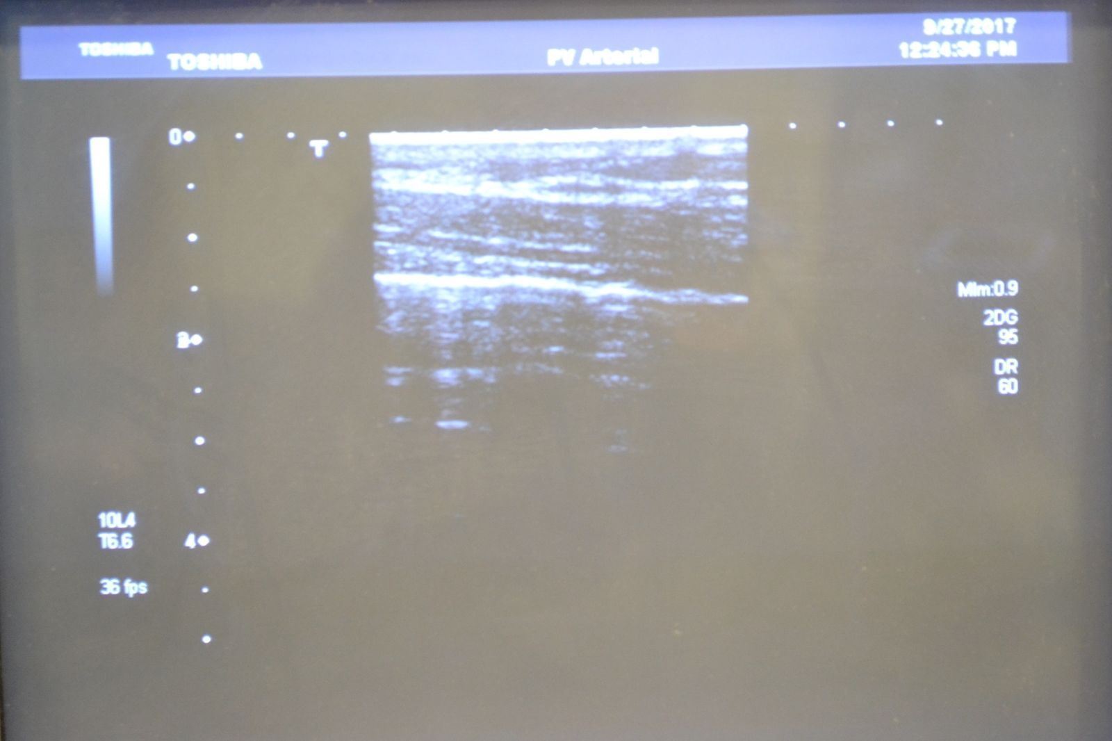 Toshiba Xario PLT-604AT 9.2-4MHz Linear Ultrasound Transducer Probe DIAGNOSTIC ULTRASOUND MACHINES FOR SALE