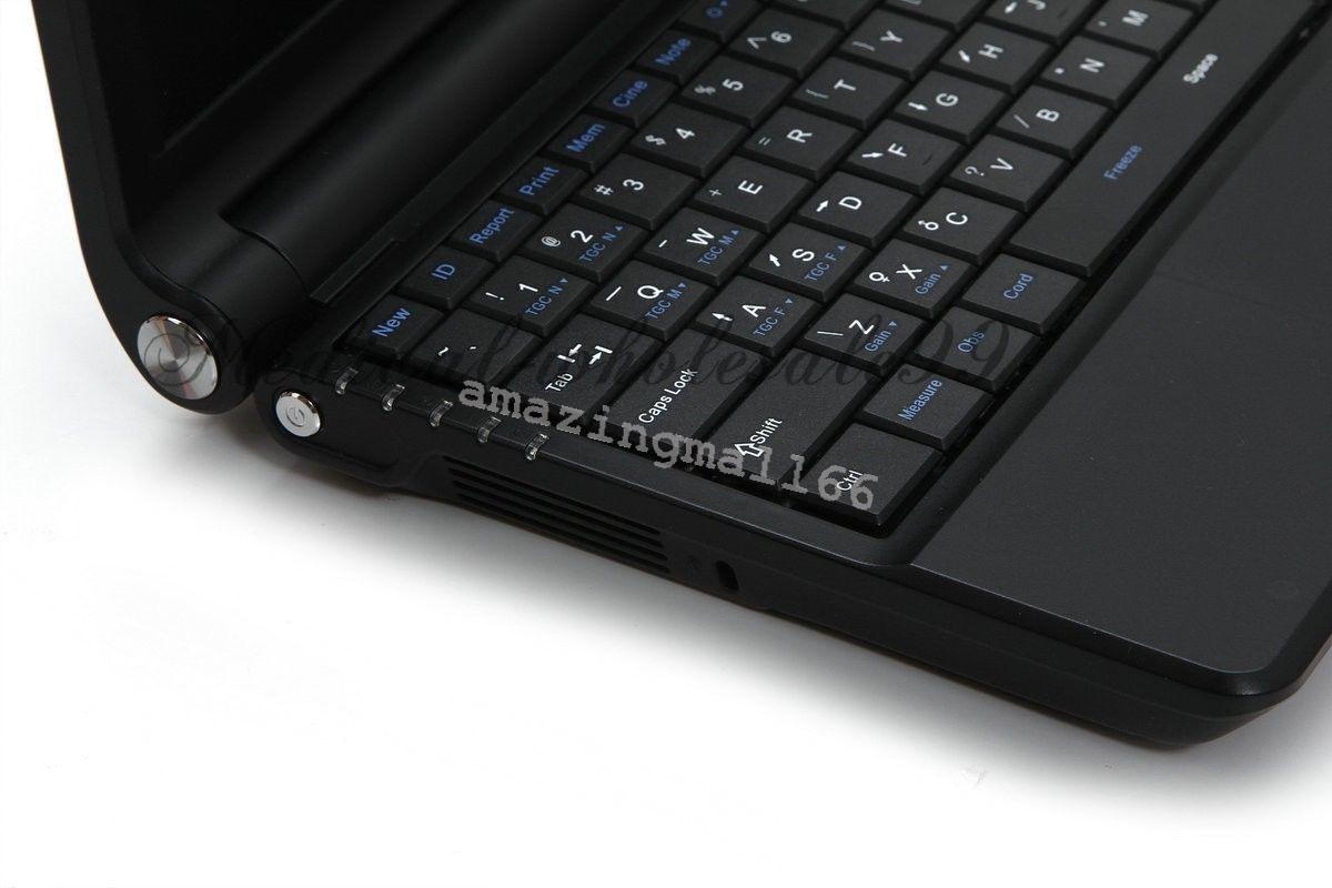 Laptop/Handheld Ultrasound Scanner/Machine Convex &Linear 2 Probe Transducer 3D 190891877994 DIAGNOSTIC ULTRASOUND MACHINES FOR SALE