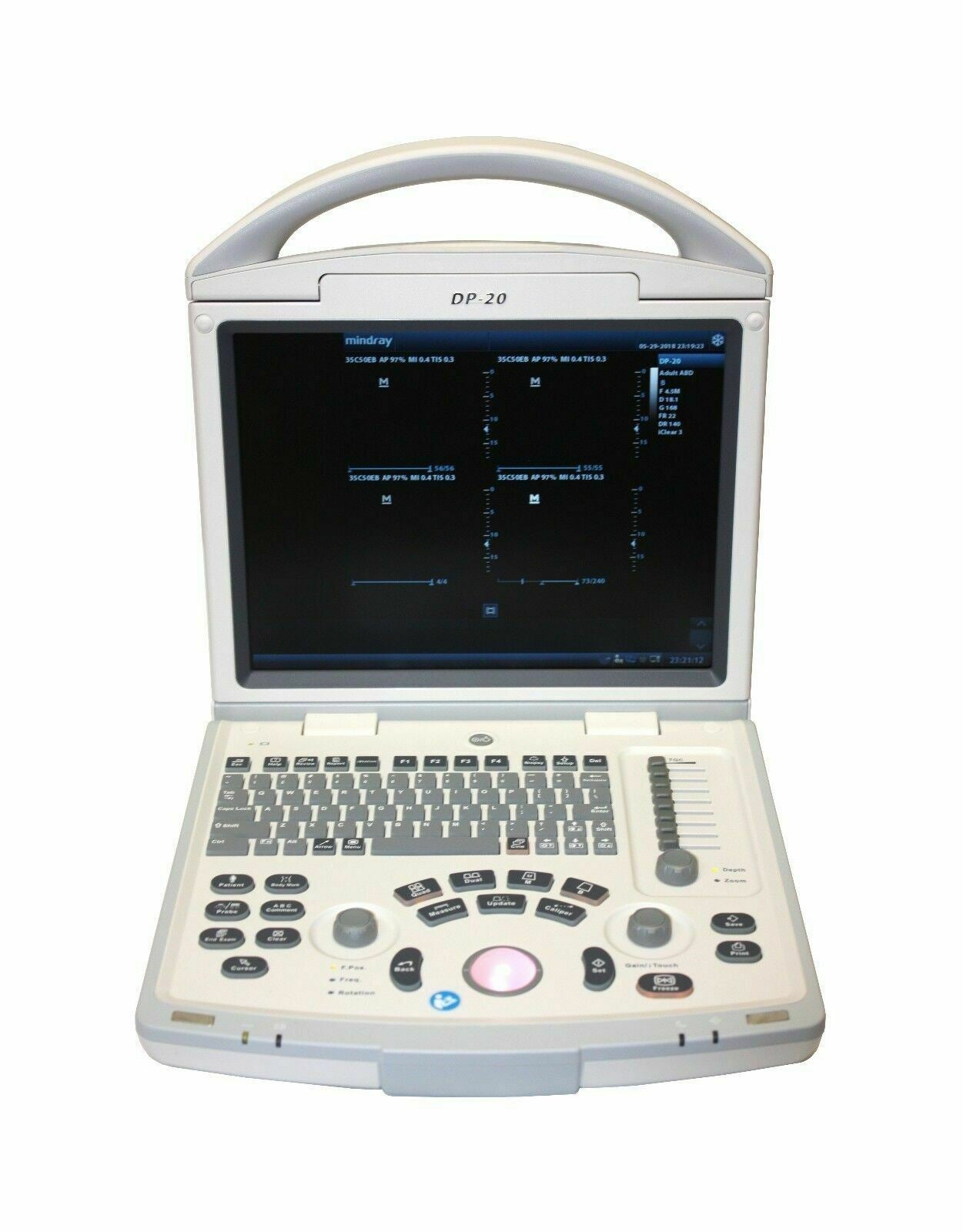 Veterinary Ultrasound K-DP-20Vet & Three Probes of Choice | KeeboMed DIAGNOSTIC ULTRASOUND MACHINES FOR SALE