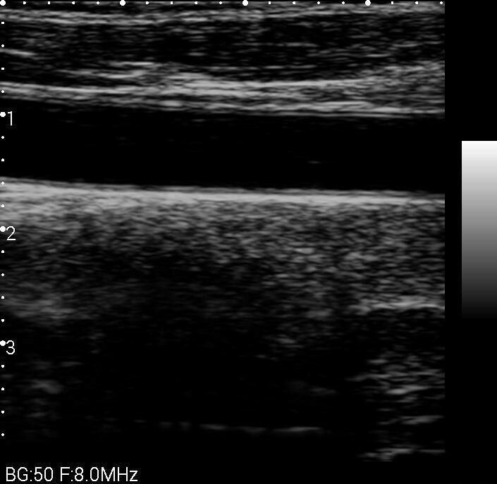 Veterinary Smart Phones Ultrasound with Convex Probe 2.5-5MHz for Animals DIAGNOSTIC ULTRASOUND MACHINES FOR SALE