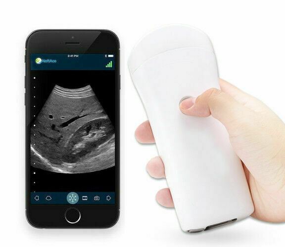 Veterinary Wifi Wireless Portable Ultrasound Scanner Convex Array Probe 3.5Mhz DIAGNOSTIC ULTRASOUND MACHINES FOR SALE