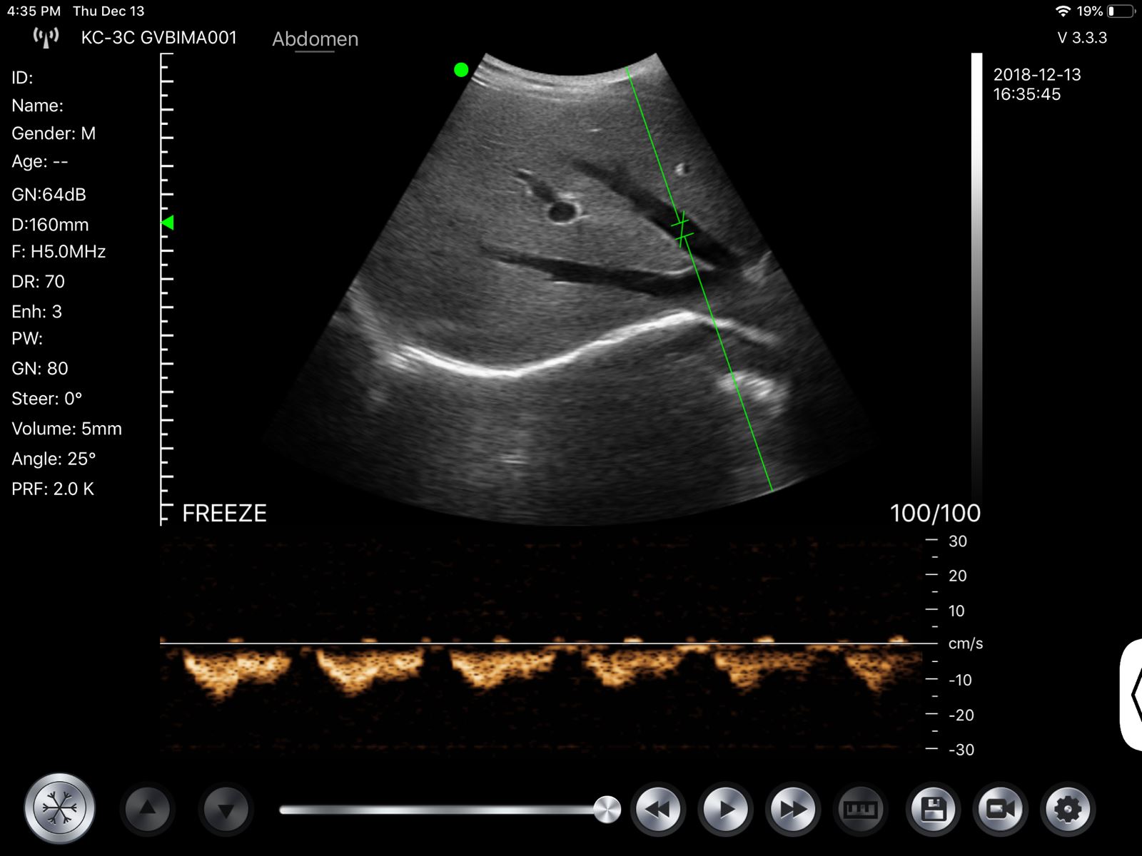 Wireless Fetal Doppler Convex Probe Veterinary Ultrasound for iPad, iPhone App DIAGNOSTIC ULTRASOUND MACHINES FOR SALE