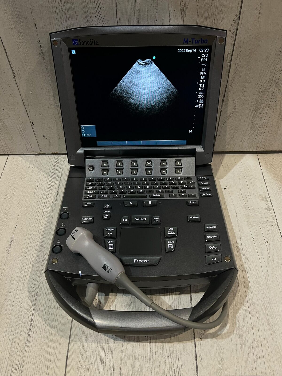 Sonosite M-Turbo Portable Ultrasound 2010 DIAGNOSTIC ULTRASOUND MACHINES FOR SALE