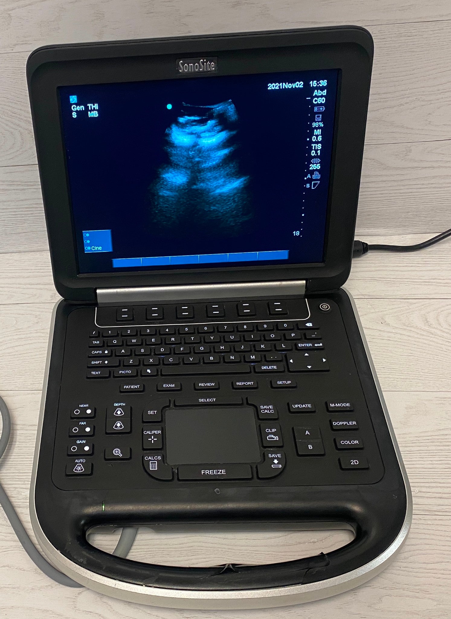 Sonosite Edge Portable ultrasound Manufactured 2012 DIAGNOSTIC ULTRASOUND MACHINES FOR SALE