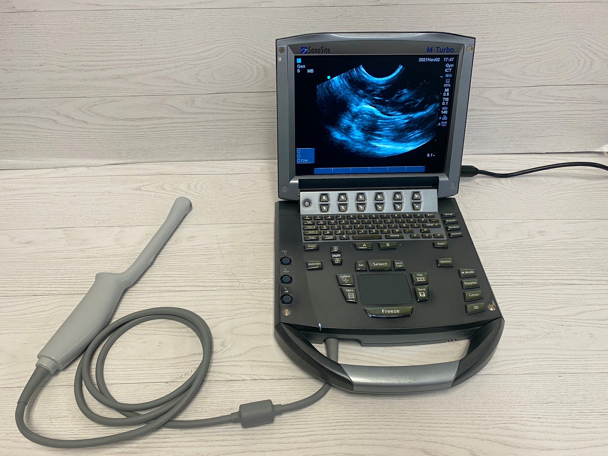 Sonosite Turbo Portable Ultrasound 2010 DIAGNOSTIC ULTRASOUND MACHINES FOR SALE