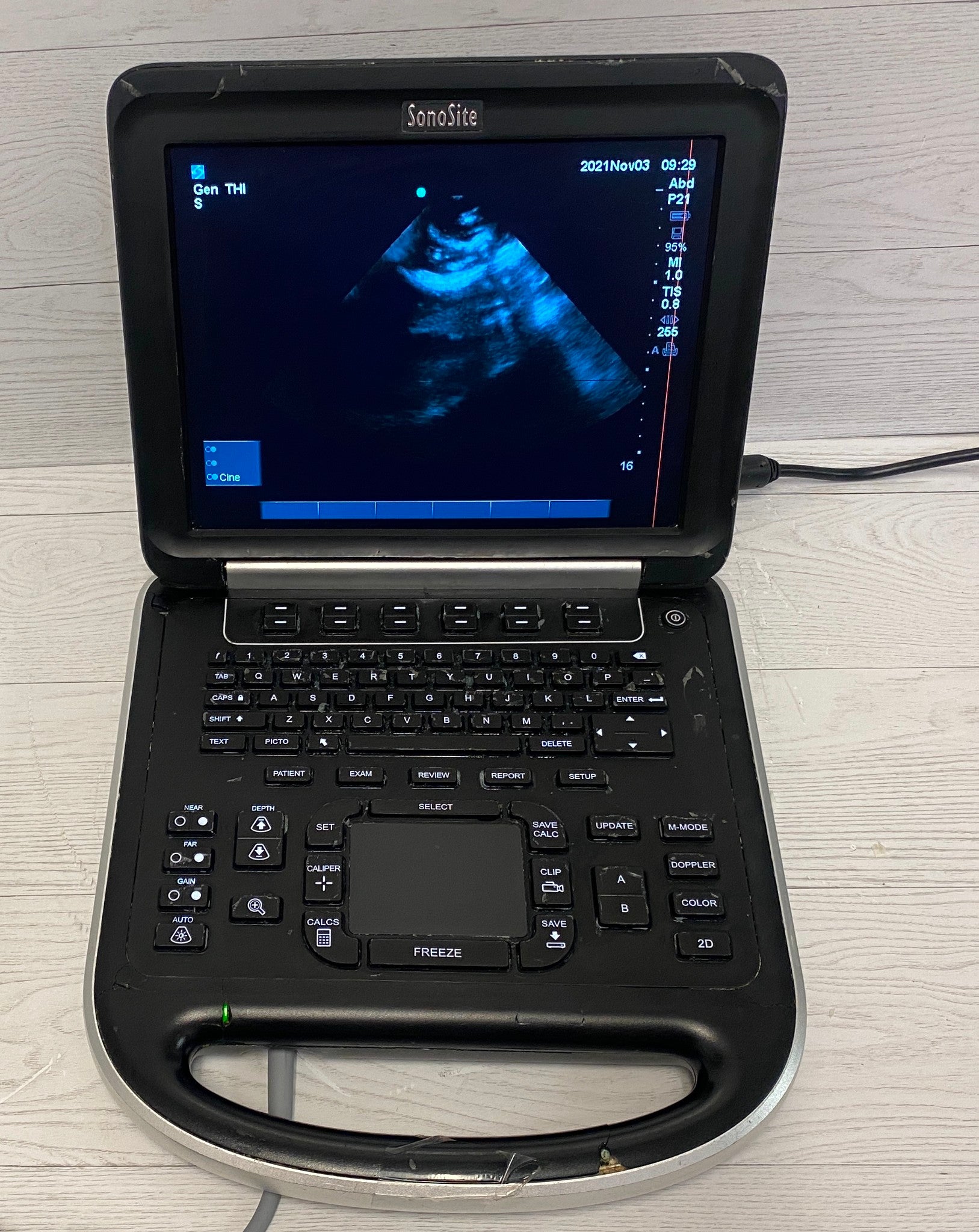 Sonosite Edge Portable ultrasound Manufactured 2014 DIAGNOSTIC ULTRASOUND MACHINES FOR SALE