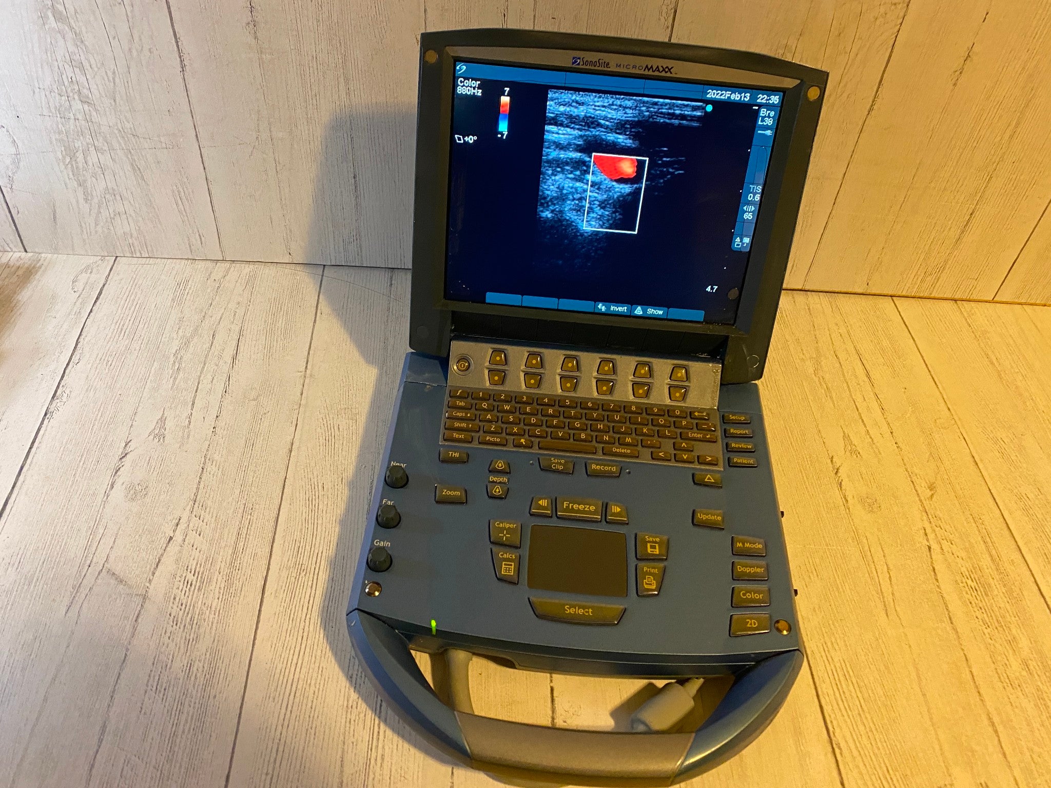 Sonosite MicroMaxx Portable Ultrasound 2007- Main unit DIAGNOSTIC ULTRASOUND MACHINES FOR SALE