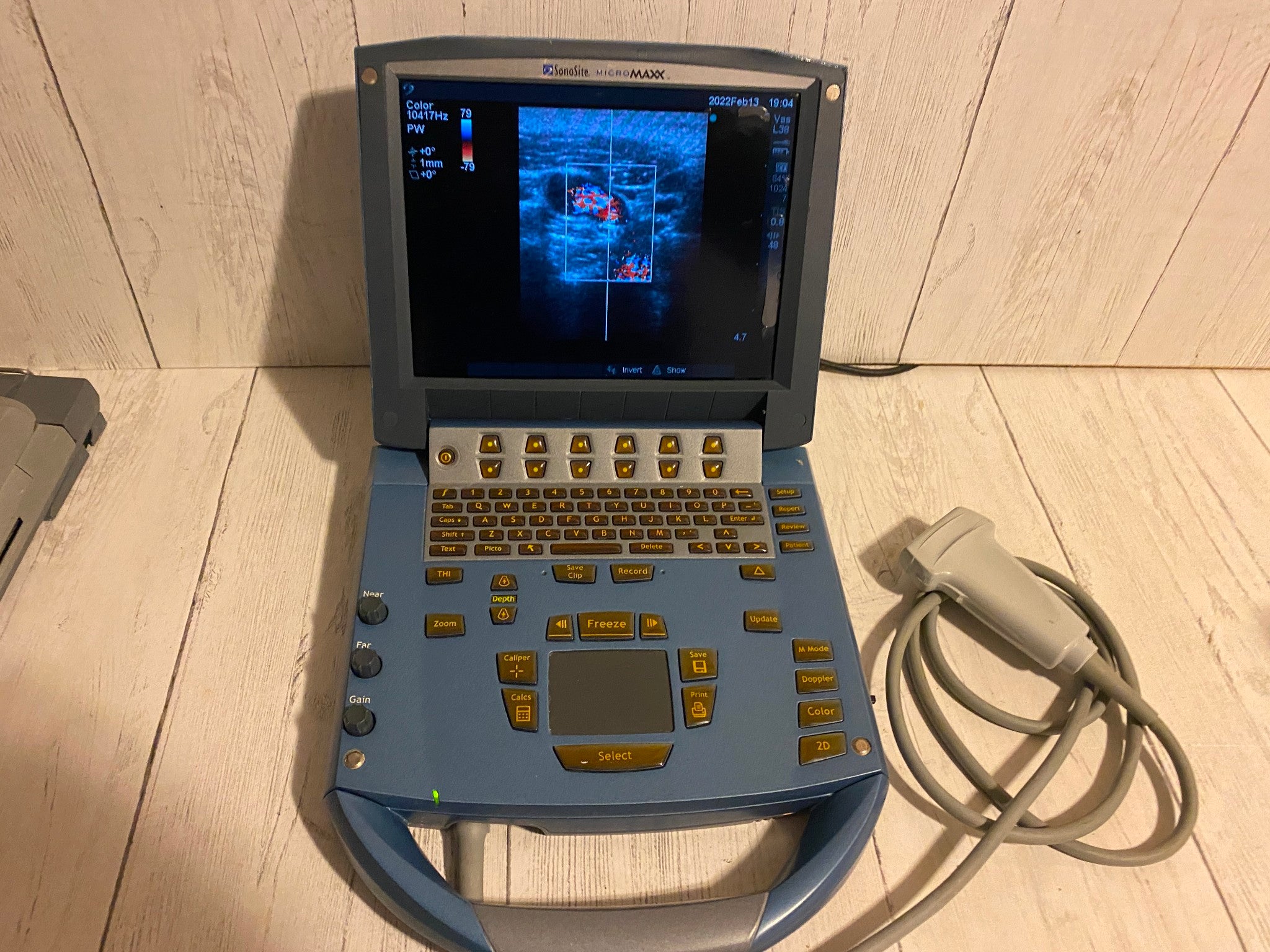 Sonosite MicroMaxx Portable Ultrasound 2005- Main unit For parts DIAGNOSTIC ULTRASOUND MACHINES FOR SALE