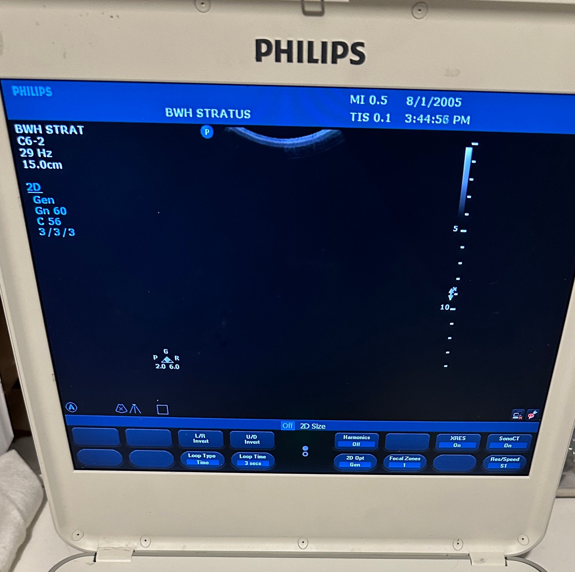 Philips C6-2 Compact Ultrasound Probe Transducer DIAGNOSTIC ULTRASOUND MACHINES FOR SALE