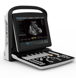 Chison ECO3