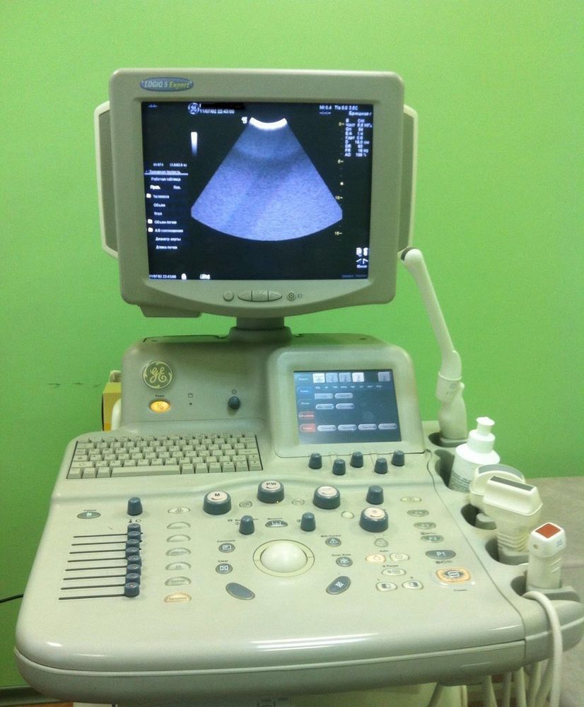 GE LOGIQ 5 EXPERT ULTRASOUND MACHINE. NO PROBES. excellent operational condition