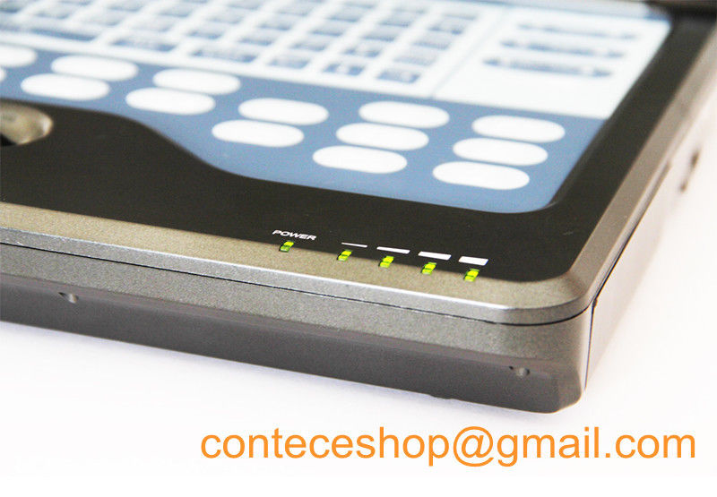 Portable laptop machine digital ultrasound scanner+probe for human,USA Warehouse DIAGNOSTIC ULTRASOUND MACHINES FOR SALE