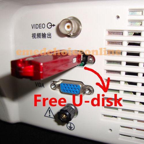 Portable Ultrasound Scanner Machine &7.5Mhz  Linear probe 2 USBs+ Free 3D Ce 190891222497 DIAGNOSTIC ULTRASOUND MACHINES FOR SALE