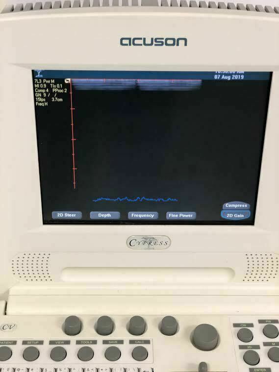 Siemens Acuson Cypress (White) Portable Ultrasound Machine with 7L3 Linear Probe DIAGNOSTIC ULTRASOUND MACHINES FOR SALE