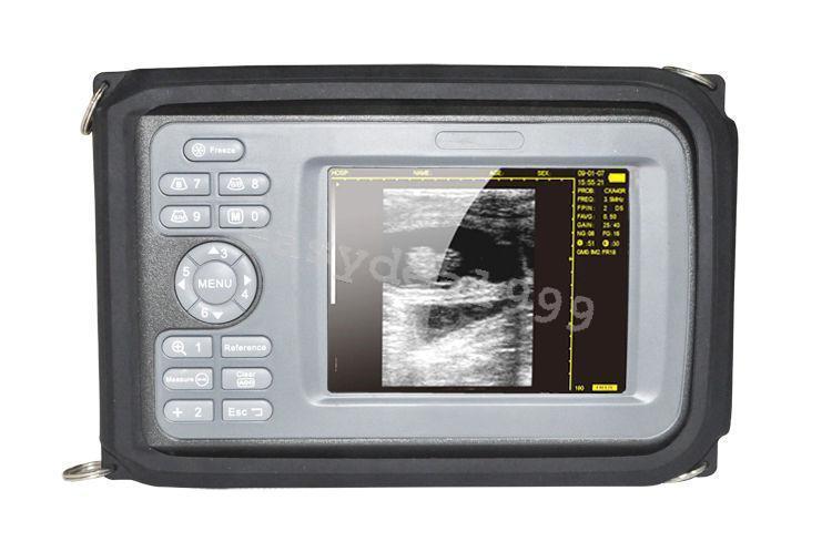 Mini Portable Handheld Digital Ultrasound Scanner Machine +Convex + Linear Probe DIAGNOSTIC ULTRASOUND MACHINES FOR SALE
