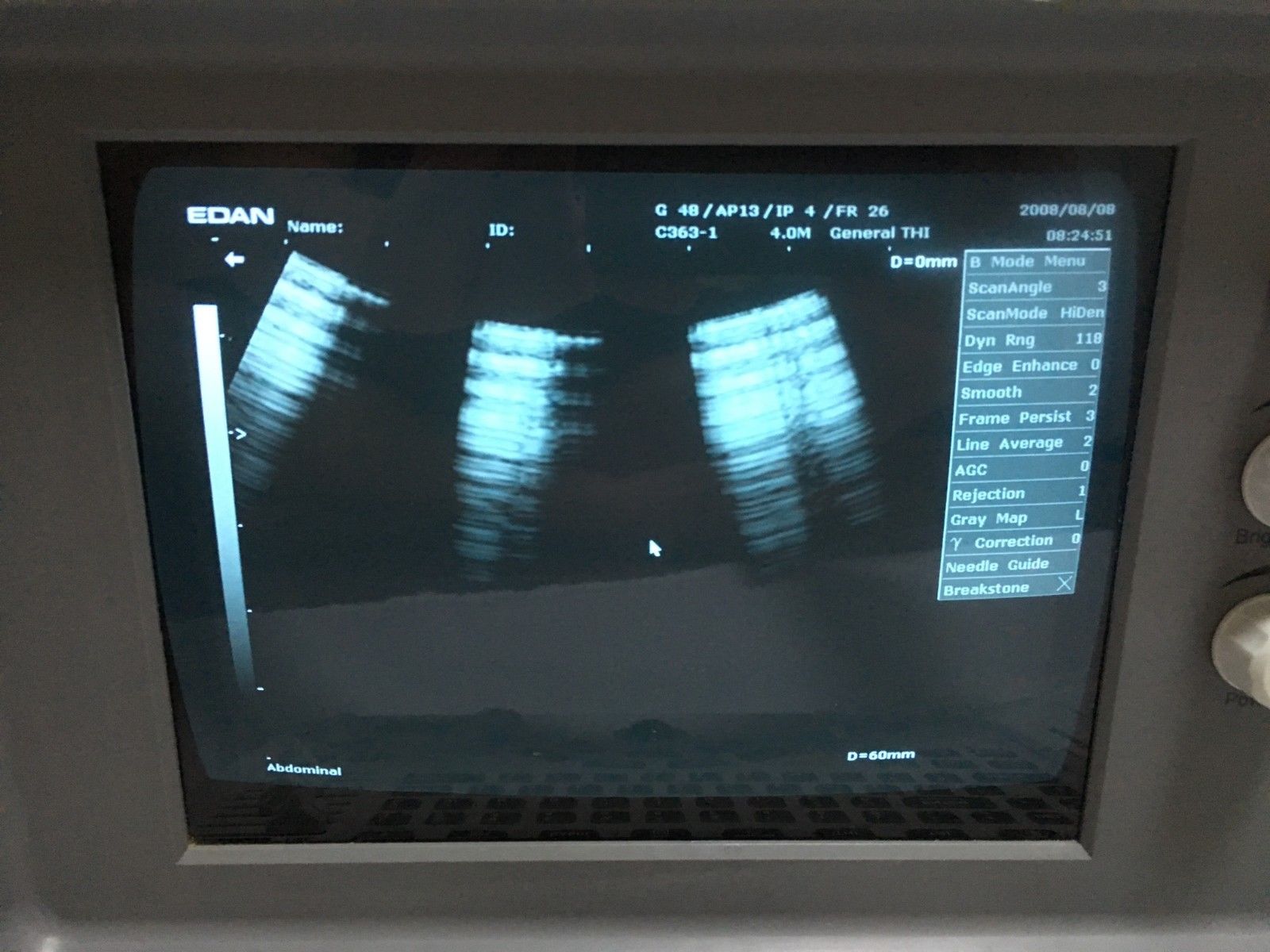 EDAN ULTRASOUND DUS-6 Ultrasonic Imaging System w/ 2 PROBES, Many EXTRAS, NICE! DIAGNOSTIC ULTRASOUND MACHINES FOR SALE