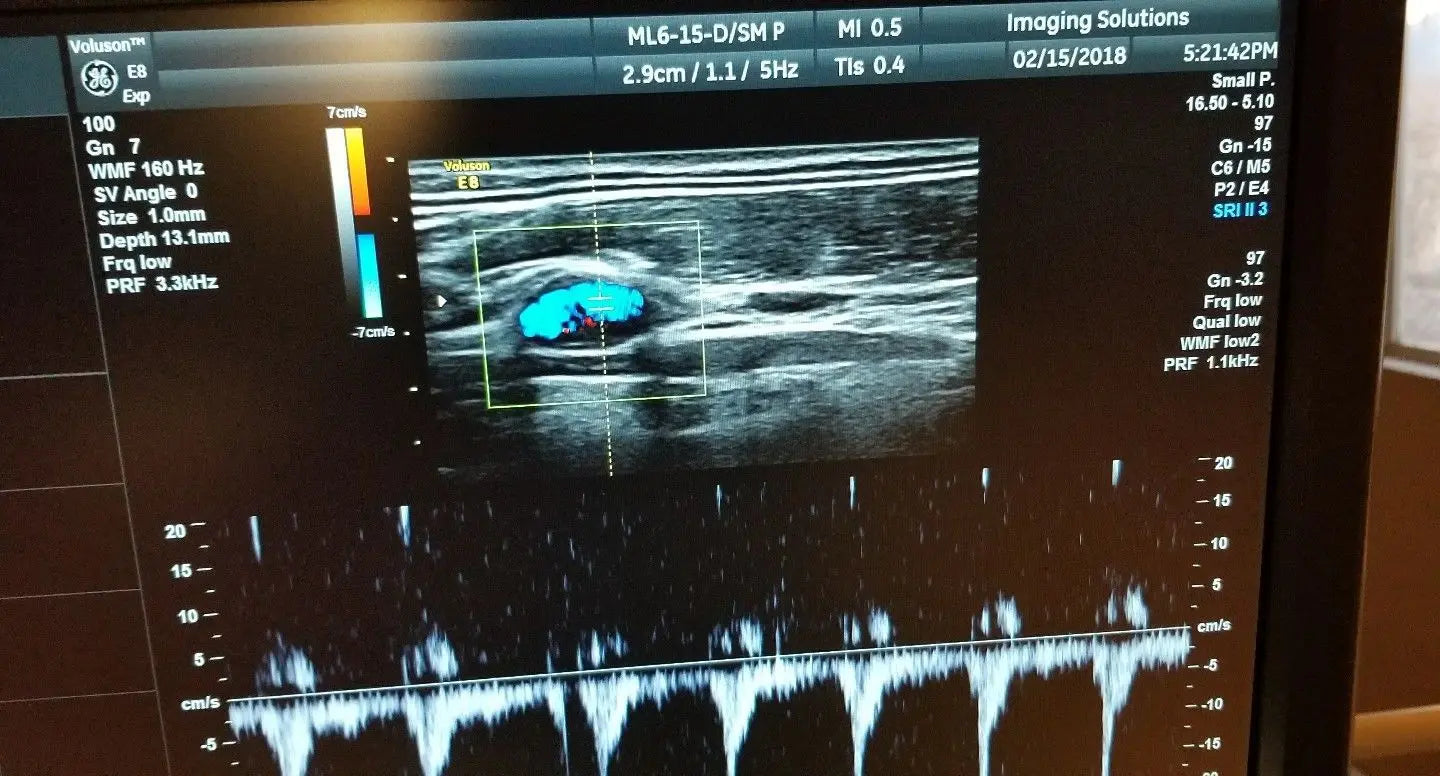 GE ML6-15-D Ultrasound Transducer / Probe DIAGNOSTIC ULTRASOUND MACHINES FOR SALE