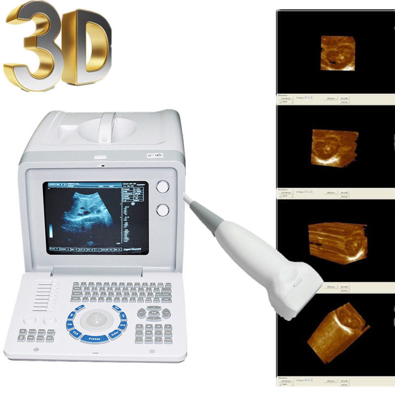 Portable LCD Digital Ultrasound Scanner with 7.5 mhz Linear Probe + 3D Software DIAGNOSTIC ULTRASOUND MACHINES FOR SALE