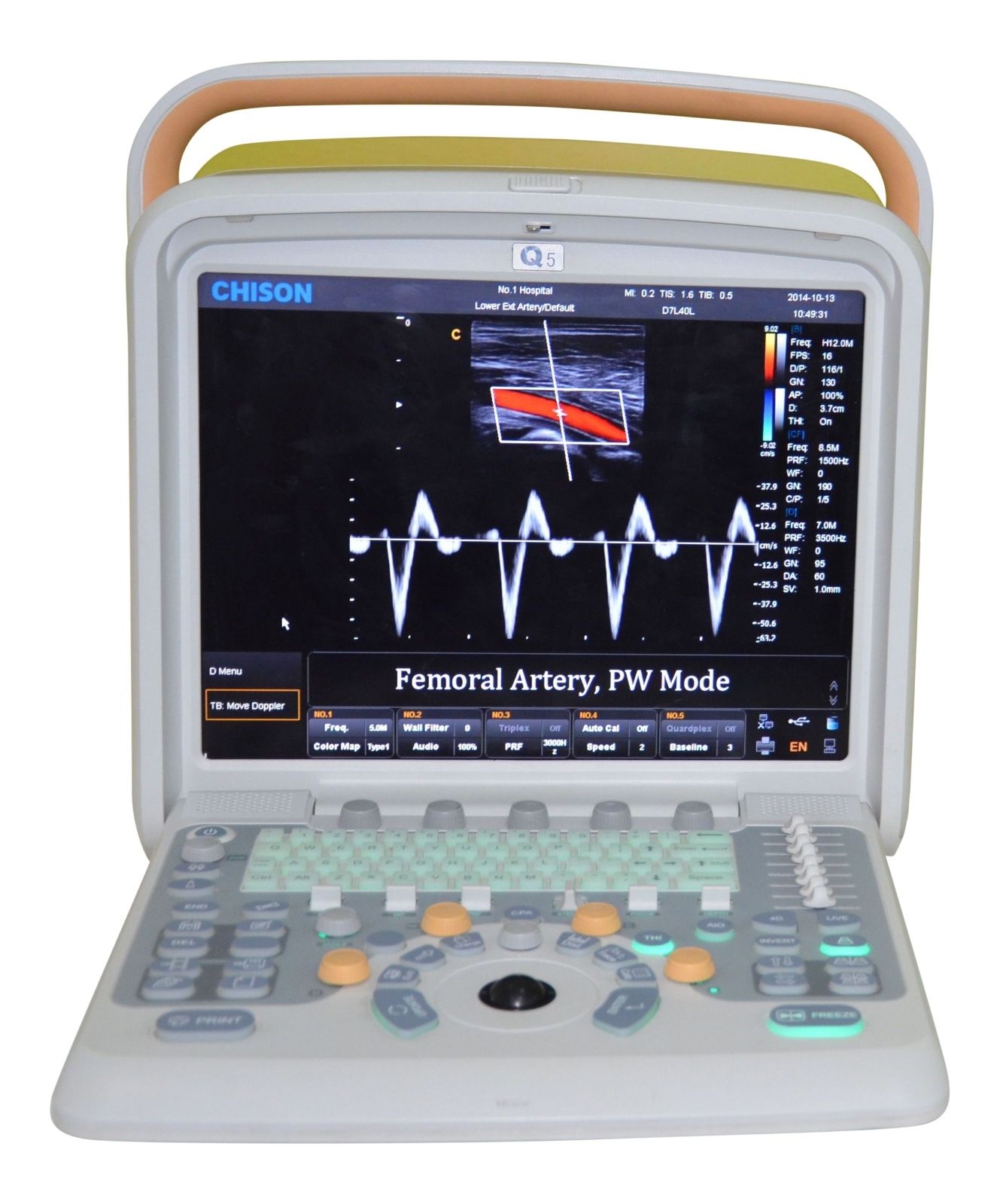 Color Doppler Ultrasound Machine With One Probe Affordable Chison Q5 DIAGNOSTIC ULTRASOUND MACHINES FOR SALE