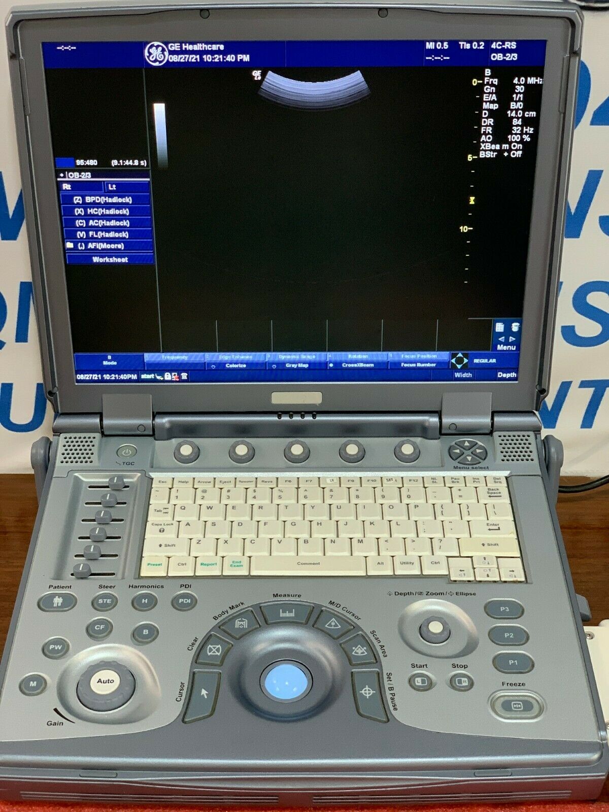 GE LOGIQ E BT11 ULTRASOUND (DOM 2011) WITH 1 TRANSDUCER INCLUDED DIAGNOSTIC ULTRASOUND MACHINES FOR SALE