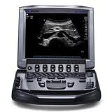 FUJIFILM Ultrasound Machine SonoSite M-Turbo - Portable System Shared Service