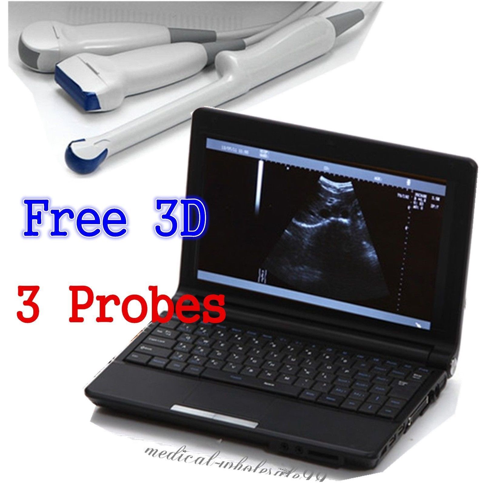 Portable Laptop Digital Ultrasound Scanner Conve/Vignal /Linear 3 Probe 3D Scan DIAGNOSTIC ULTRASOUND MACHINES FOR SALE