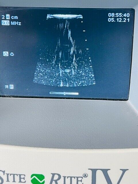 BARD SITE RITE IV ULTRASOUND WITH PROBE ON ROLLING STAND (w221) DIAGNOSTIC ULTRASOUND MACHINES FOR SALE