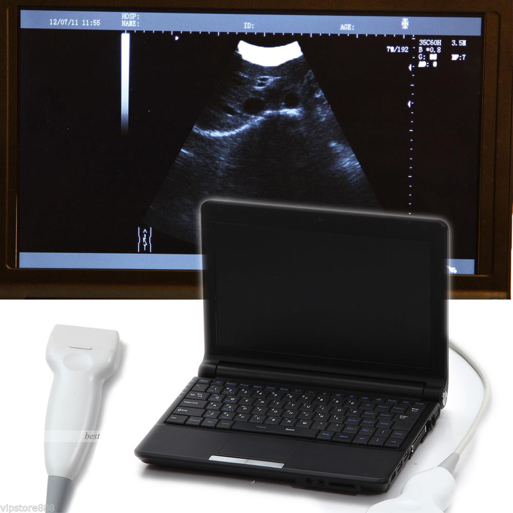Full Digital Laptop Ultrasound Scanner Linear 9000F + Free 3D Linear probe DHL! DIAGNOSTIC ULTRASOUND MACHINES FOR SALE