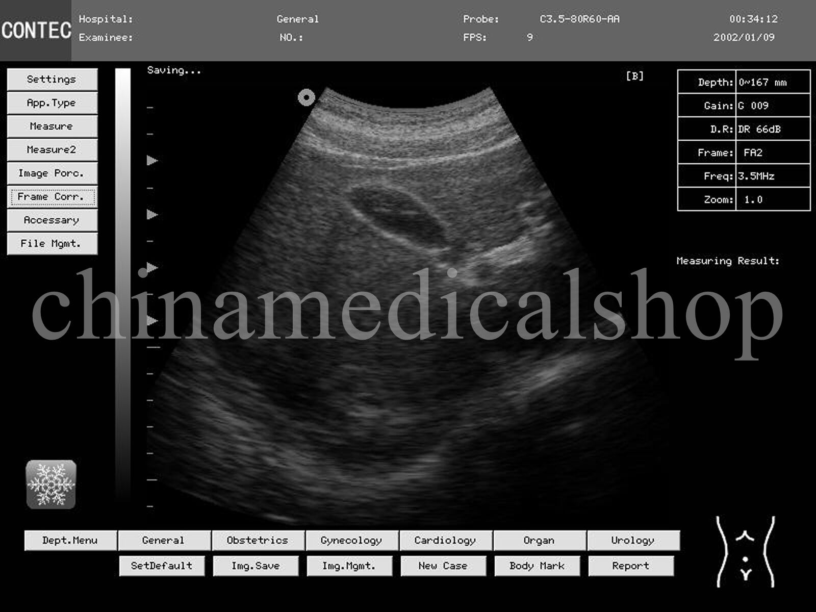 With Convex &Cardiac Sensors Digital Ultrasound Scanner Ultrasonic Machine USA DIAGNOSTIC ULTRASOUND MACHINES FOR SALE