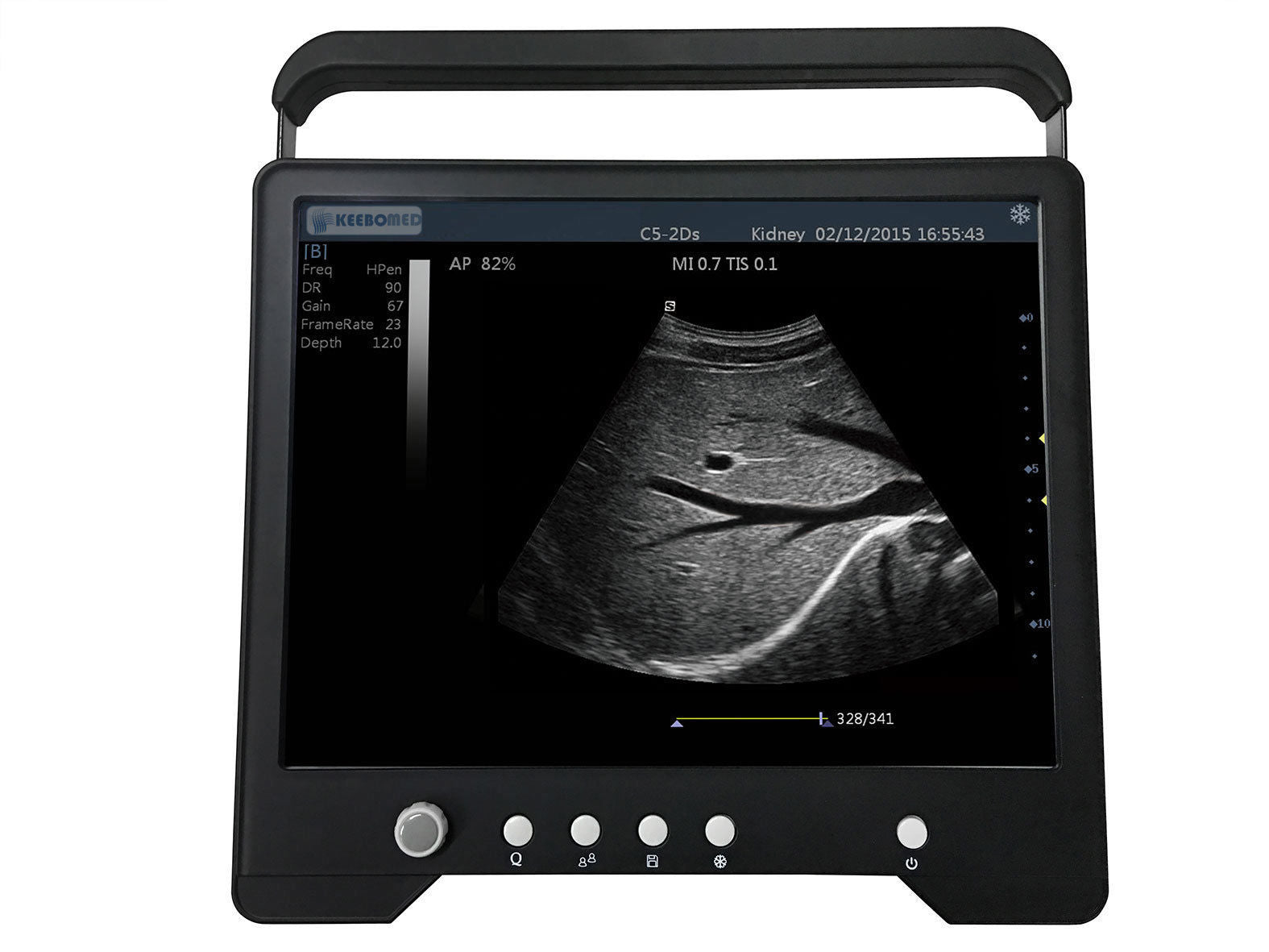 Veterinary Touch Screen-Reptiles, Equine Ultrasound&Linear Array Probe, KeeboMed DIAGNOSTIC ULTRASOUND MACHINES FOR SALE