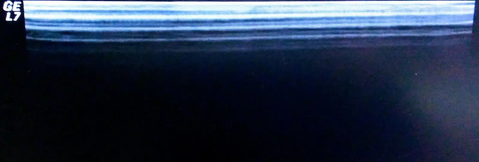 GE 10L Linear Ultrasound Transducer  for GE Logiq Systems DIAGNOSTIC ULTRASOUND MACHINES FOR SALE