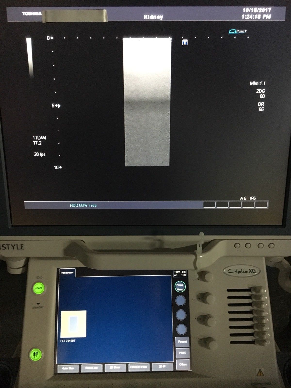 Toshiba Aplio PLT-704SBT Ultrasound Linear Array Vascular Transducer Probe DIAGNOSTIC ULTRASOUND MACHINES FOR SALE