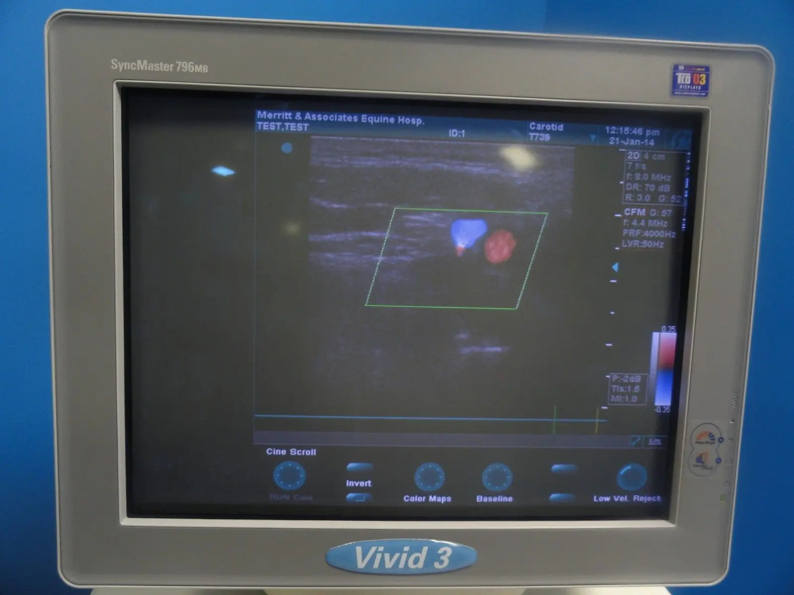 GE T739 P/N 2128151-2 6.7/D5.0 MHz  Linear Array Ultrasound Transducer (6246) DIAGNOSTIC ULTRASOUND MACHINES FOR SALE