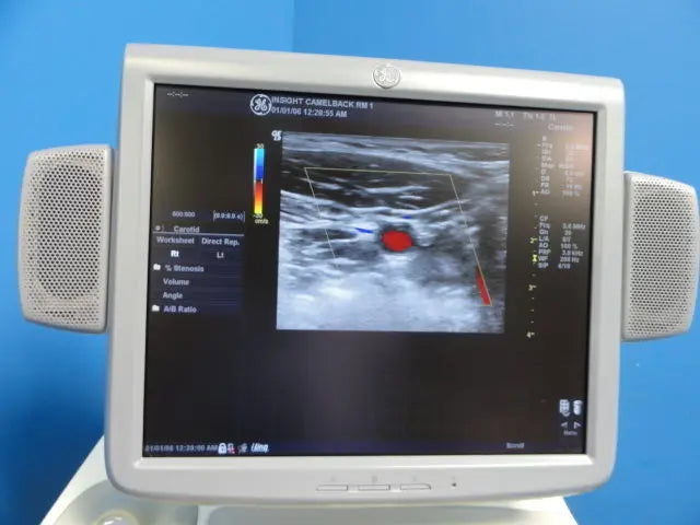 GE  7L Linear Array Ultrasound Transducer for Logiq & Vivid Series (10760) DIAGNOSTIC ULTRASOUND MACHINES FOR SALE