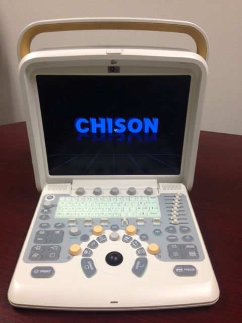 NEW Chison Q5 Portable Ultrasound System