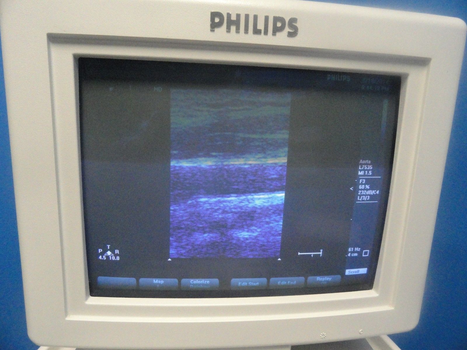 a computer monitor with a picture of a BODY PART the screen