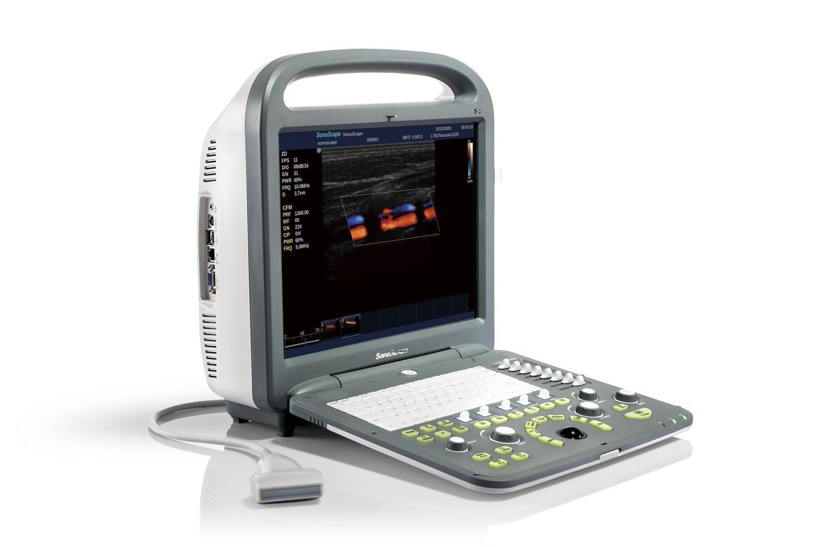 Used SonoScape S2 with Linear Array Probe L741 Excellent Condition,MSK,Vascular DIAGNOSTIC ULTRASOUND MACHINES FOR SALE