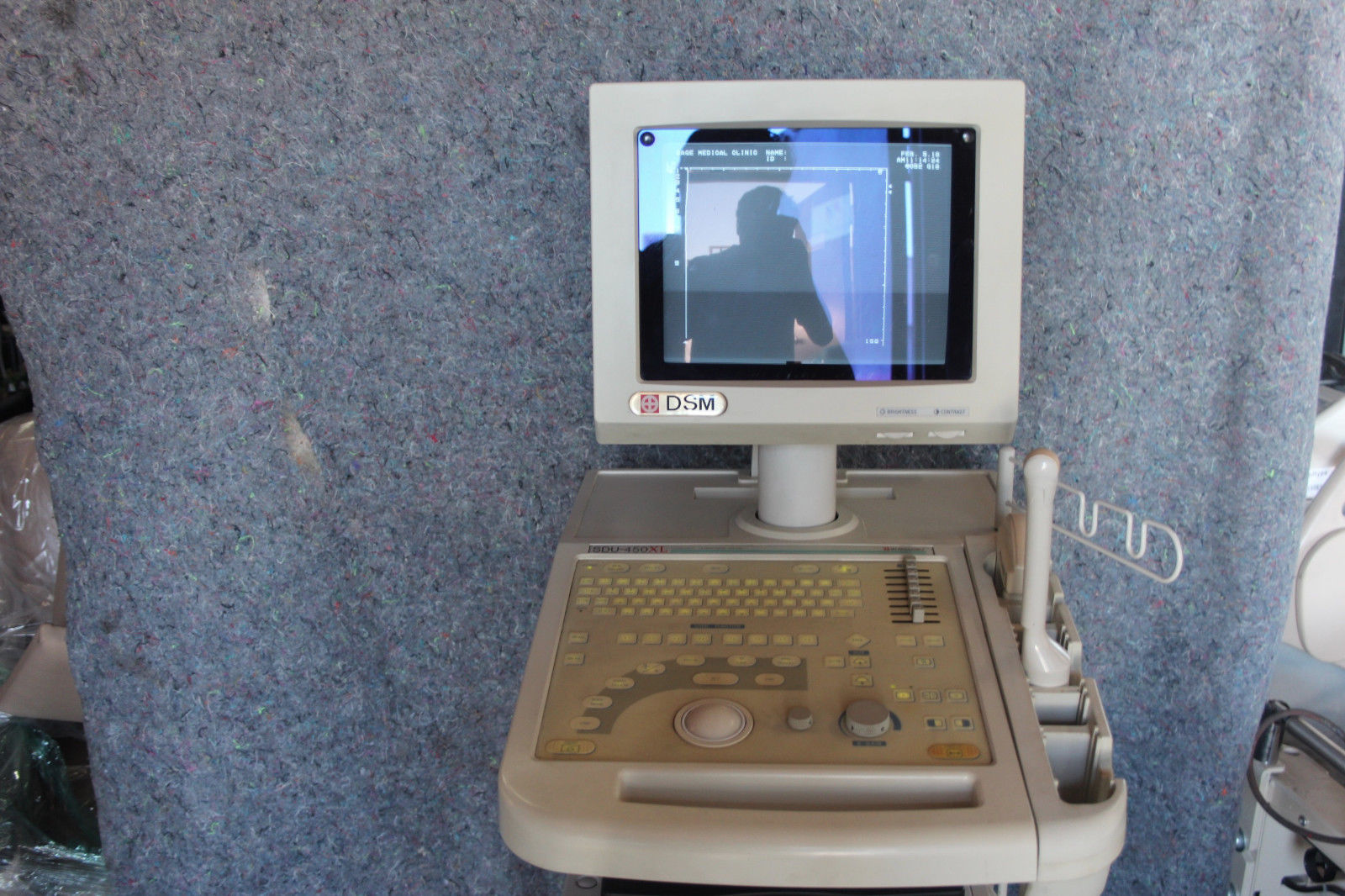 Shimadzu Diagnostic Ultrasound system SDU-450XL w/ two probes DIAGNOSTIC ULTRASOUND MACHINES FOR SALE