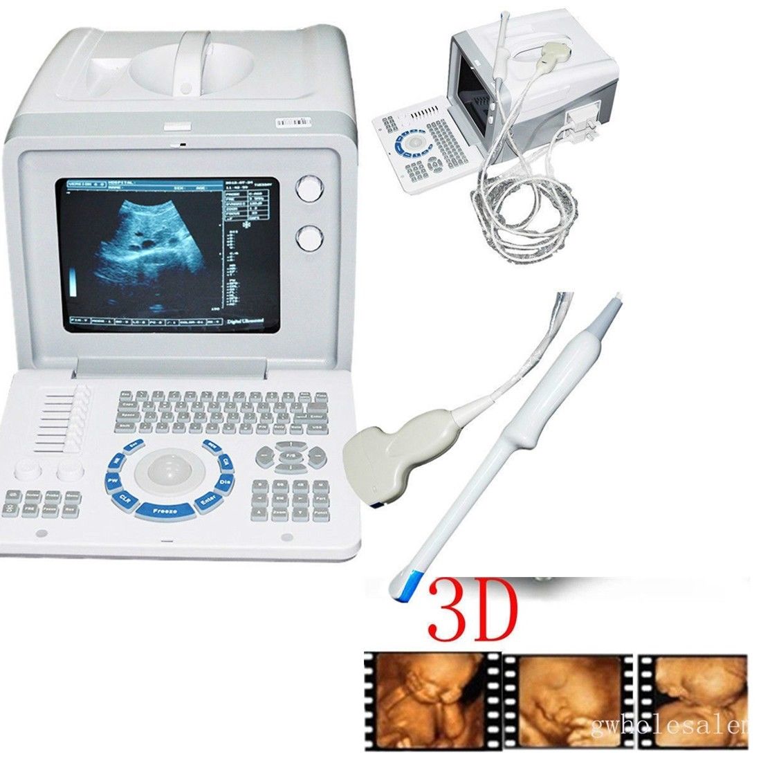 Set 3D Digital Portable Ultrasound Scanner Machine Convex +Transvaginal Probe CE 190891781949 DIAGNOSTIC ULTRASOUND MACHINES FOR SALE