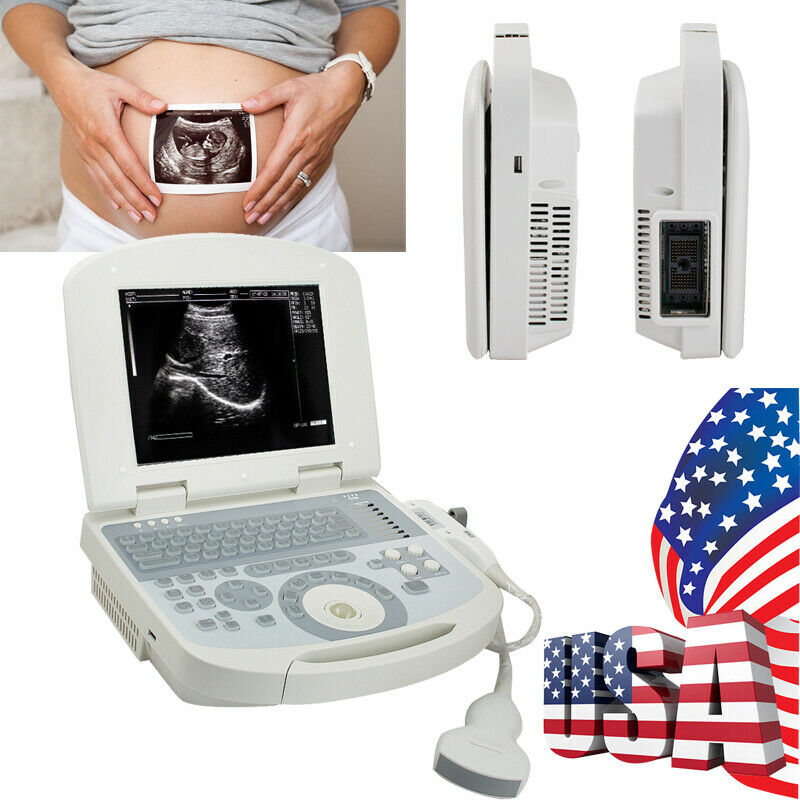 Portable laptop machine Full Digital Ultrasound Ultrasonic scanner Convex probe DIAGNOSTIC ULTRASOUND MACHINES FOR SALE