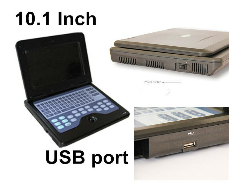 Portable Laptop Ultrasound Scanner Machine Digital Human Tranvaginal Probe DIAGNOSTIC ULTRASOUND MACHINES FOR SALE