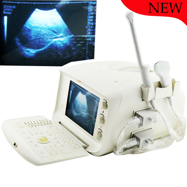 New Digital Ultrasound Scanner Machine System CE, Convex + Transvaginal Probe 3D 190891052773 DIAGNOSTIC ULTRASOUND MACHINES FOR SALE