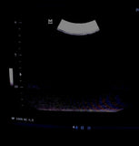 Esaote original used CA541 ultrasound probe good working ultrasound transducer