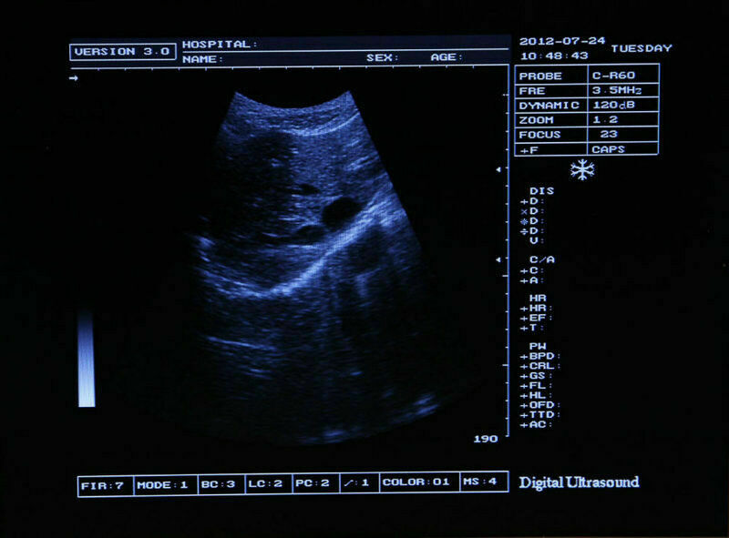 Portable LCD Digital Ultrasound Scanner Machine Convex+Transvaginal 2 Probe DHL DIAGNOSTIC ULTRASOUND MACHINES FOR SALE