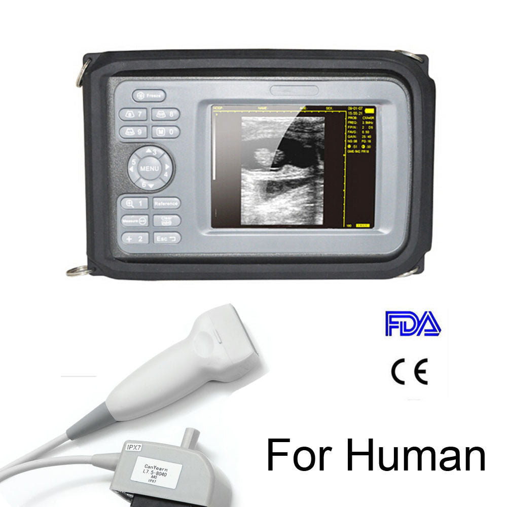 Handheld Ultrasound  Scanner Digital Machine w Linear Probe Free Box & Battery 190891515230 DIAGNOSTIC ULTRASOUND MACHINES FOR SALE