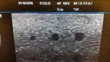 Mindray M5 Ultrasound w/cart