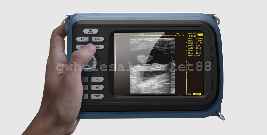 Veterinary Digital Palm Ultrasound Scanner Animal Rectal Probe +Dogs Cows Horses DIAGNOSTIC ULTRASOUND MACHINES FOR SALE