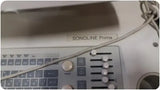 SIEMENS SONOLINE PRIMA 4900580LV300 DIAGNOSTIC ULTRASOUND MACHINE WITH PROBE%