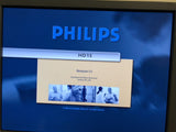 Philips HD15 Ultrasound Machine